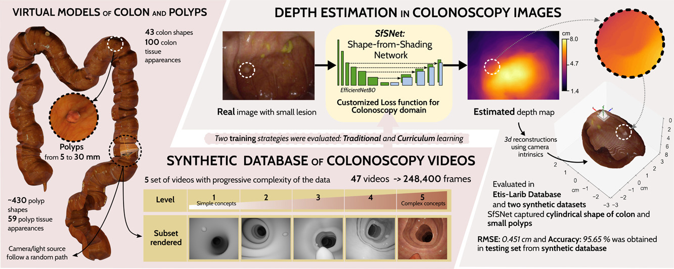 CMIG'24 SfSNet: Curriculum learning of colonscopy depth maps for assisted gastroenterology